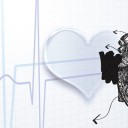 Choroby sieroce układu krążenia