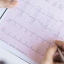 Niewydolność serca – algorytm leczenia