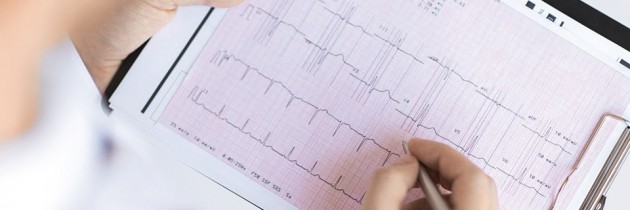 Niewydolność serca – algorytm leczenia